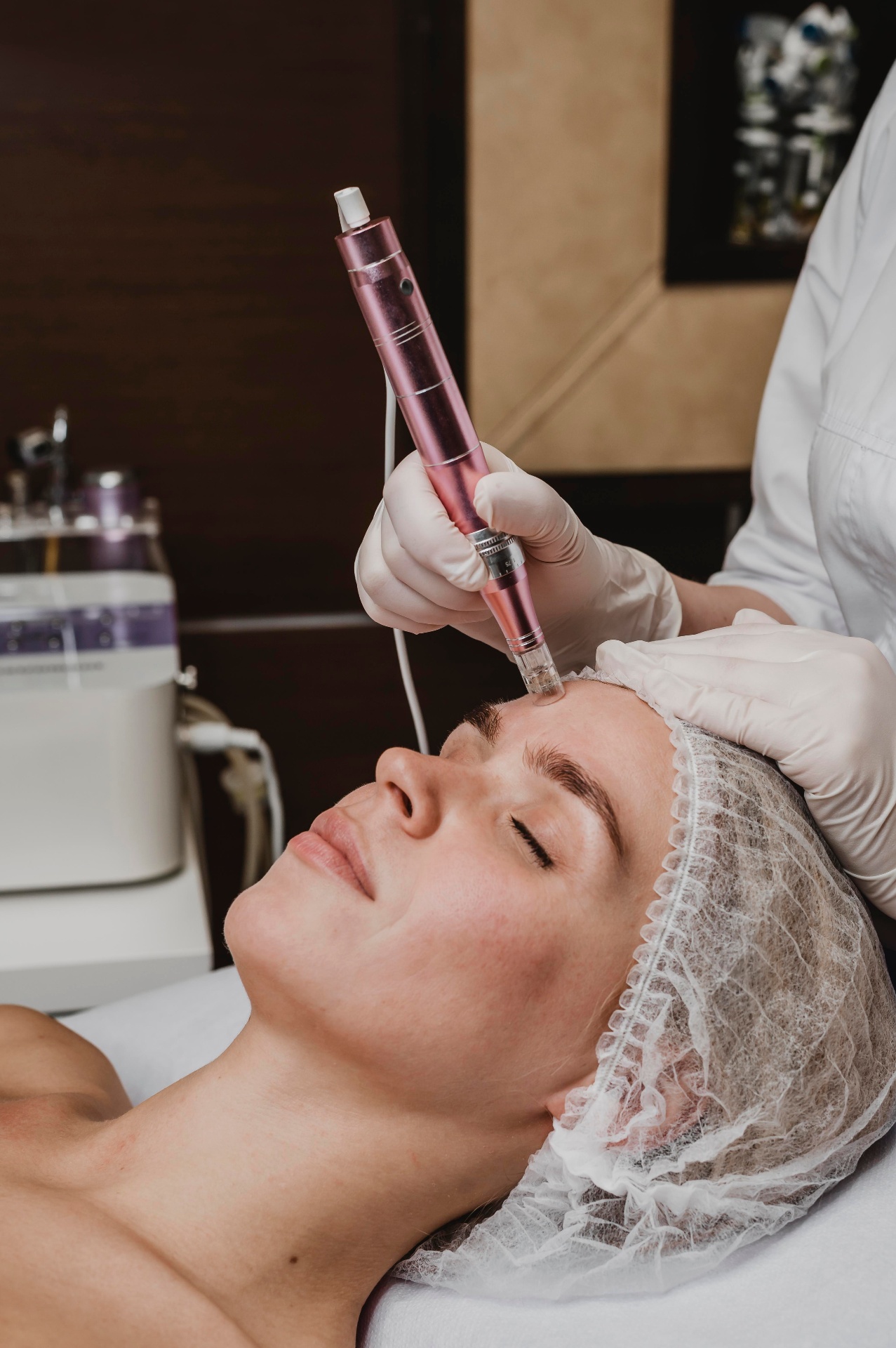 Microneedling med eksosomer i ansiktet